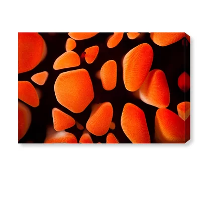 Slate Pencil Sea Urchin by David Fleetham - Photograph Print on Canvas